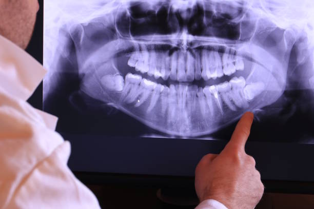 Best Emergency Dental Extractions in Macdonnell Heights, NY