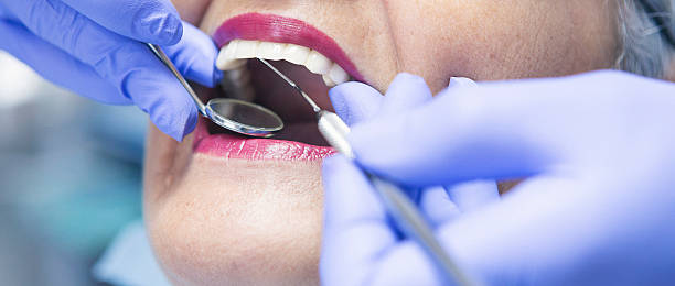 Best Broken or Cracked Tooth Emergency Dentist in Macdonnell Heights, NY