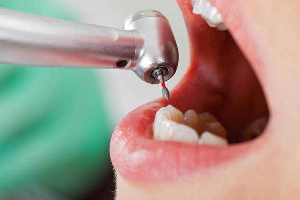 Best Emergency Dental Services for Seniors in Macdonnell Heights, NY